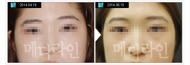 ������Ī�̹���